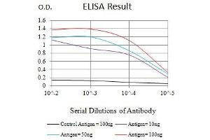 Black line: Control Antigen (100 ng),Purple line: Antigen (10 ng), Blue line: Antigen (50 ng), Red line:Antigen (100 ng)