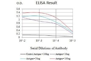 Black line: Control Antigen (100 ng),Purple line: Antigen (10 ng), Blue line: Antigen (50 ng), Red line:Antigen (100 ng) (SAA1 anticorps  (AA 19-212))
