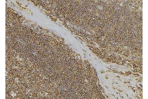 ABIN6279673 at 1/100 staining Human lymph node tissue by IHC-P. (PABPC3 anticorps)