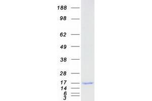 Validation with Western Blot