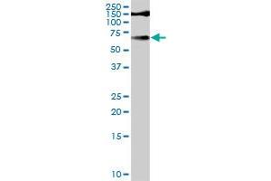 TYR MaxPab rabbit polyclonal antibody.