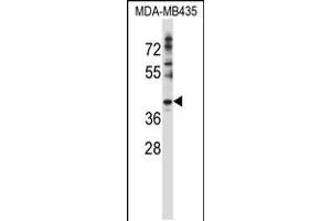 Western blot analysis in MDA-MB435 cell line lysates (35ug/lane). (DNAJC28 anticorps  (C-Term))