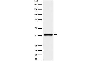 Western blot analysis of UCHL5IP expression in HeLa cell lysate.