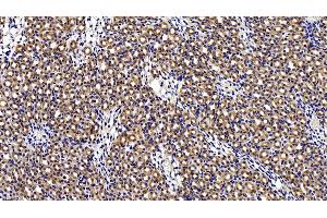 Detection of CTSS in Mouse Kidney Tissue using Polyclonal Antibody to Cathepsin S (CTSS)