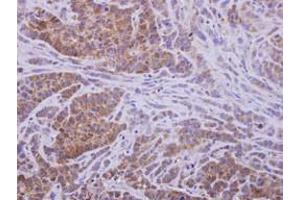 Image no. 1 for anti-Aldo-Keto Reductase Family 1, Member D1 (AKR1D1) (AA 1-326) antibody (ABIN1496548)