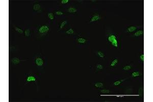 Immunofluorescence of purified MaxPab antibody to CRKL on HeLa cell.