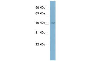 WB Suggested Anti-LASS1 Antibody Titration:  0. (LASS1 anticorps  (Middle Region))