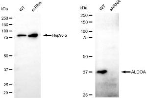 Western blotting analysis using ALDOA antibody (ABIN7797573).