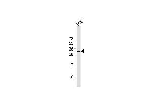 Anti-HLA-DQA1 Antibody (N-term) at 1:1000 dilution + Raji whole cell lysate Lysates/proteins at 20 μg per lane.