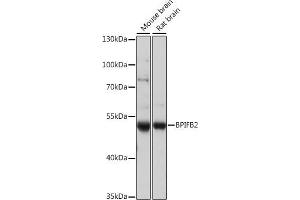 Western blot analysis of extracts of various cell lines, using BPIFB2 antibody (ABIN7265907) at 1:1000 dilution. (BPIL1 anticorps  (AA 40-340))