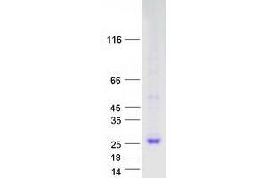 Validation with Western Blot