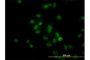 Immunofluorescence of monoclonal antibody to HDAC1 on HeLa cell.