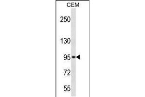 Western blot analysis in CEM cell line lysates (35ug/lane).