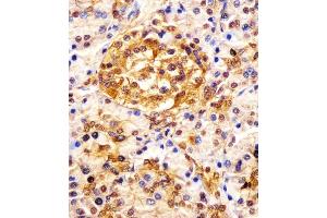 (ABIN652121 and ABIN2840556) staining ESRP1 in human pancreas tissue sections by Immunohistochemistry (IHC-P - paraformaldehyde-fixed, paraffin-embedded sections). (ESRP1 anticorps  (AA 182-211))