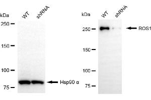 Western blotting analysis using ROS1 antibody (ABIN7797813). (ROS1 anticorps)