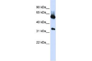 WB Suggested Anti-ALAS2 Antibody Titration:  0. (ALAS2 anticorps  (N-Term))