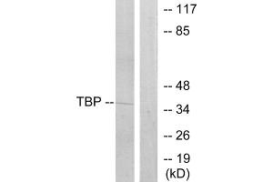 Western blot analysis of extracts from 293 cells, using TBP antibody. (TBP anticorps  (Internal Region))