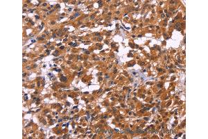 Immunohistochemistry of Human brain  using MSH4 Polyclonal Antibody at dilution of 1:30 (MSH4 anticorps)