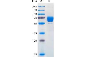 Human M-CSF Protein, mFc Tag on SDS-PAGE under reducing condition.