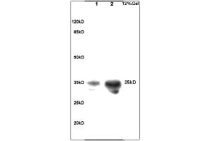 Western Blotting (WB) image for anti-Coagulation Factor III (thromboplastin, Tissue Factor) (F3) (AA 32-100) antibody (ABIN708086)
