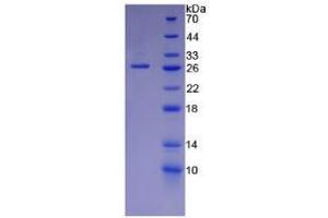 SDS-PAGE analysis of Mouse Laminin alpha 5 Protein. (Laminin alpha 5 Protéine)
