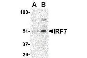 Western Blotting (WB) image for anti-Interferon Regulatory Factor 7 (IRF7) (Center) antibody (ABIN2475145) (IRF7 anticorps  (Center))