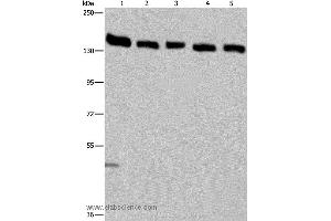 Western blot analysis of Hela cell and human testis tissue, A549, Jurkat and K562 cell, using IPO4 Polyclonal Antibody at dilution of 1:550 (Importin 4 anticorps)
