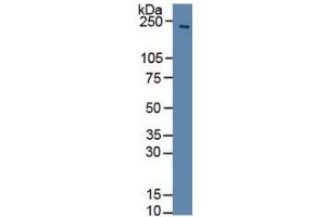 Rabbit Capture antibody from the kit in WB with Positive Control: Sample Rat brain tissue.
