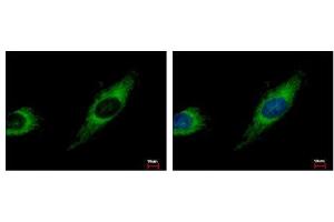 Image no. 3 for anti-Transforming Growth Factor beta Regulator 4 (TBRG4) (AA 1-328) antibody (ABIN1501337) (TBRG4 anticorps  (AA 1-328))