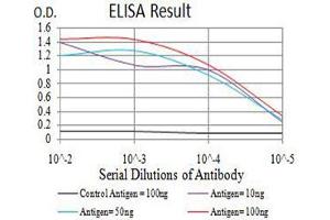 Black line: Control Antigen (100 ng),Purple line: Antigen (10 ng), Blue line: Antigen (50 ng), Red line:Antigen (100 ng)