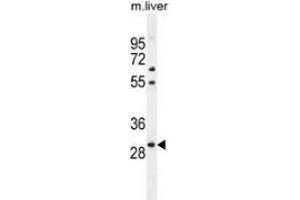 Western blot analysis in mouse liver tissue lysates (35ug/lane) using PHOX2B  Antibody . (PHOX2B anticorps  (Middle Region))
