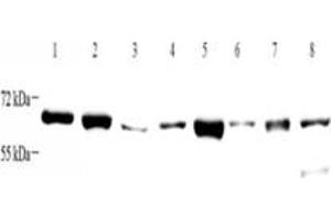 Western blot analysis of ZCCHC7 (ABIN7076279) at dilution of 1: 4000,Lane 1: HeLa cell lysate,Lane 2: K562 cell lysate,Lane 3: HL60 cell lysate,Lane 4: Mouse brain tissue lysate,Lane 5: Mouse kidney tissue lysate,Lane 6: Rat brain tissue lysate,Lane 7: Rat kidney tissue lysate,Lane 8: Rat uterus tissue lysate (ZCCHC7 anticorps)