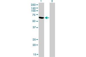 Western Blot analysis of RBM5 expression in transfected 293T cell line by RBM5 monoclonal antibody (M01), clone 2B6. (RBM5 anticorps  (AA 75-184))