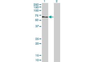 Western Blot analysis of STK3 expression in transfected 293T cell line by STK3 monoclonal antibody (M13A), clone 4F7.