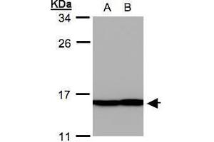 WB Image Sample(30 ug whole cell lysate) A: A431, B: H1299 12% SDS PAGE antibody diluted at 1:500 (PFN2 anticorps)