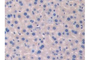 Detection of F5 in Mouse Liver Tissue using Polyclonal Antibody to Coagulation Factor V (F5)