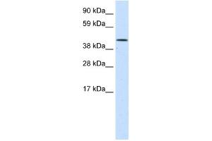 WB Suggested Anti-SMARCA1 Antibody Titration:  1. (SMARCA1 anticorps  (N-Term))