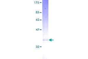 Image no. 1 for Microsomal Glutathione S-Transferase 3 (MGST3) (AA 1-152) protein (GST tag) (ABIN1310896)