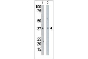 The anti-PDXK Pab is used in Western blot to detect PDXK in mouse intestine tissue lysate (Lane 1) and Hela cell lysate (Lane 2). (PDXK anticorps  (N-Term))