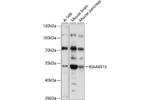 Western blot analysis of extracts of various cell lines, using KI antibody (ABIN7268113) at 1:1000 dilution. (KIAA0513 anticorps  (AA 1-301))