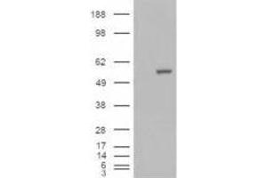 Image no. 2 for anti-Aldehyde Dehydrogenase 1 Family, Member A1 (ALDH1A1) (C-Term) antibody (ABIN374078) (ALDH1A1 anticorps  (C-Term))
