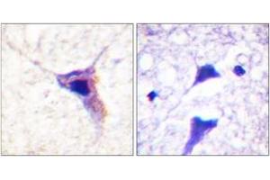 Immunohistochemistry analysis of paraffin-embedded human brain, using Synapsin1 (Phospho-Ser62) Antibody.