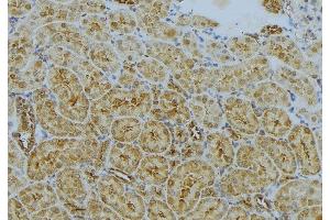 ABIN6272992 at 1/100 staining Mouse kidney tissue by IHC-P. (CLTA anticorps)