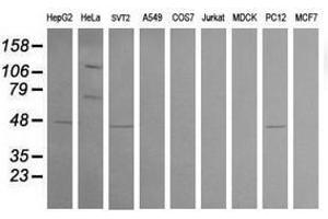 Image no. 6 for anti-Carboxypeptidase A2 (Pancreatic) (CPA2) antibody (ABIN1497598)