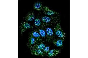 Confocal immunofluorescent analysis of Phospho-ABL1- Antibody (ABIN389502 and ABIN2839560) with MCF-7 cell followed by Alexa Fluor 488-conjugated goat anti-rabbit lgG (green).
