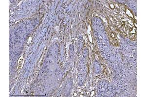 IHC analysis of Integrin linked ILK using anti-Integrin linked ILK antibody (ABIN7599410).