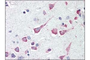 Image no. 1 for anti-Death-Associated Protein Kinase 3 (DAPK3) (Center) antibody (ABIN303252) (DAPK3 anticorps  (Center))