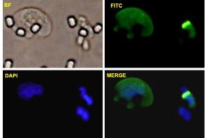 U-2 OS cells were stained with ZEB1-FITC labeled monoclonal antibody (Green). (ZEB1 anticorps  (AA 801-900))