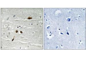 Immunohistochemical analysis of paraffin-embedded human brain tissue using MDC1 (Phospho-Ser513) antibody (left)or the same antibody preincubated with blocking peptide (right). (MDC1 anticorps  (pSer513))