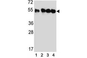 Western blot analysis of TUBB2C antibody and (1) HeLa, (2) MDA-MB435, (3) MDA-MB231, and (4) HepG2 lysate. (TUBB2C anticorps  (AA 99-125))